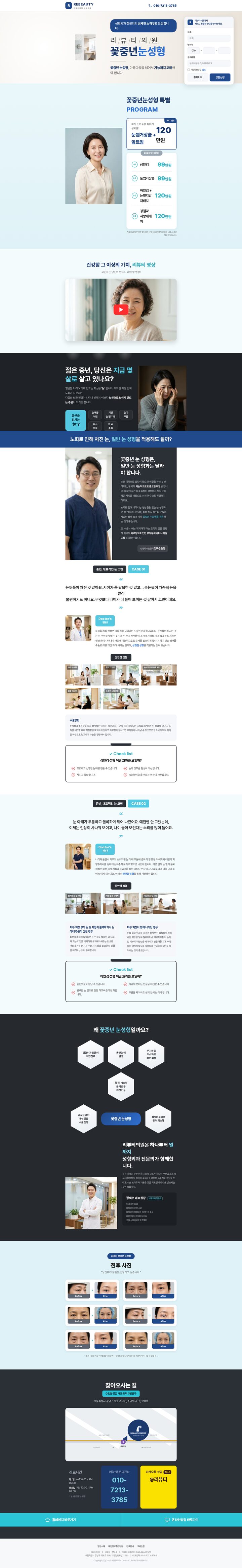 성형외과 꽃중년 눈성형 이벤트 랜딩 페이지 — 상안검·하안검 가격표와 상담 폼 레이아웃